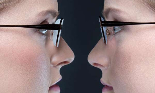 ΟΔΗΓΟΣ ΦΡΟΝΤΙΔΑΣ ΚΑΙ ΠΡΟΣΤΑΣΙΑΣ ΓΙΑ ΤΟΥΣ ΦΑΚΟΥΣ ΤΩΝ ΓΥΑΛΙΩΝ ΣΟΥ